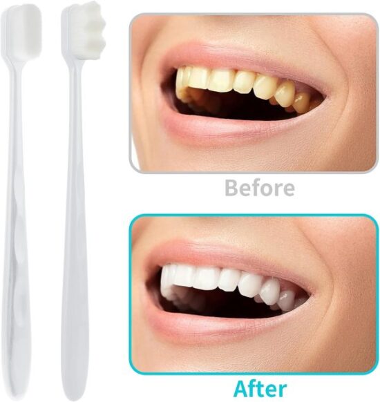Soft Tooth Brush – Micro Nano Tooth Brush For Sensitive Gums Toothbrush With Extra Soft Floss (random Color) - Image 6